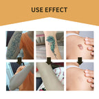 Invisible Concealer Patch Skin concealer tattoo scar cover-up stickers - Coverage look